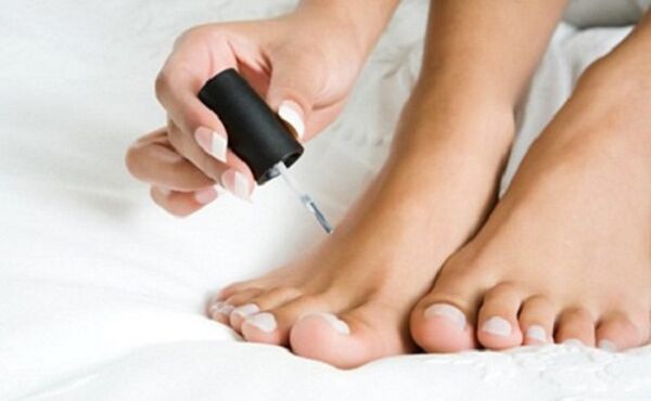 Healing lacquer from nail fungi