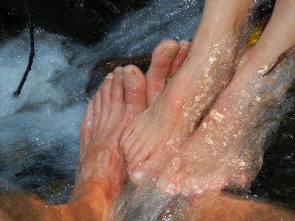 Micosu of the nails of the feet